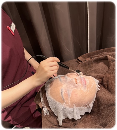 イオン導入 美白 ビタミンCトラネキサム酸 施術写真